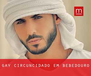 Gay Circuncidado em Bebedouro